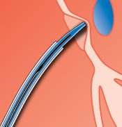 Tenting the Interatrial Septum